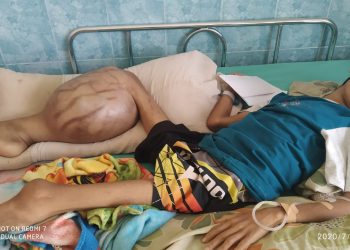 Kholis Bocah Penyandang Tumor Tulang Ganas Di Kaki Belum Bisa Dirujuk