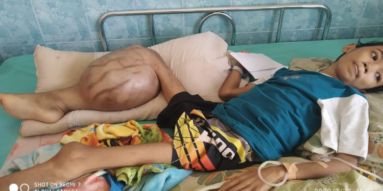 Kholis Bocah Penyandang Tumor Tulang Ganas Di Kaki Belum Bisa Dirujuk