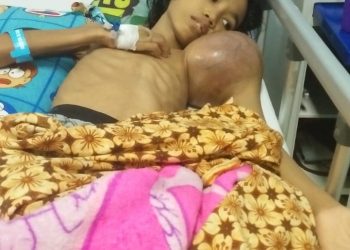 Kholis, Kembali Butuhkan Bantuan Dermawan Untuk Obati Tumor Ganas Yang Muncul Di Tangan Kiri