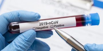 Bertambah Lagi 6 Orang Pasien Positif Covid-19 Di Kabupaten Merangin. Total Berjumlah 28